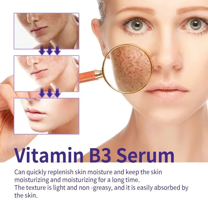 Hoygi Niacinamide Facial Serum Vitamin B3 Wrinkles Pigment Dark Spot Removal Correcting Glow Serum Face Whitening Moisturizer