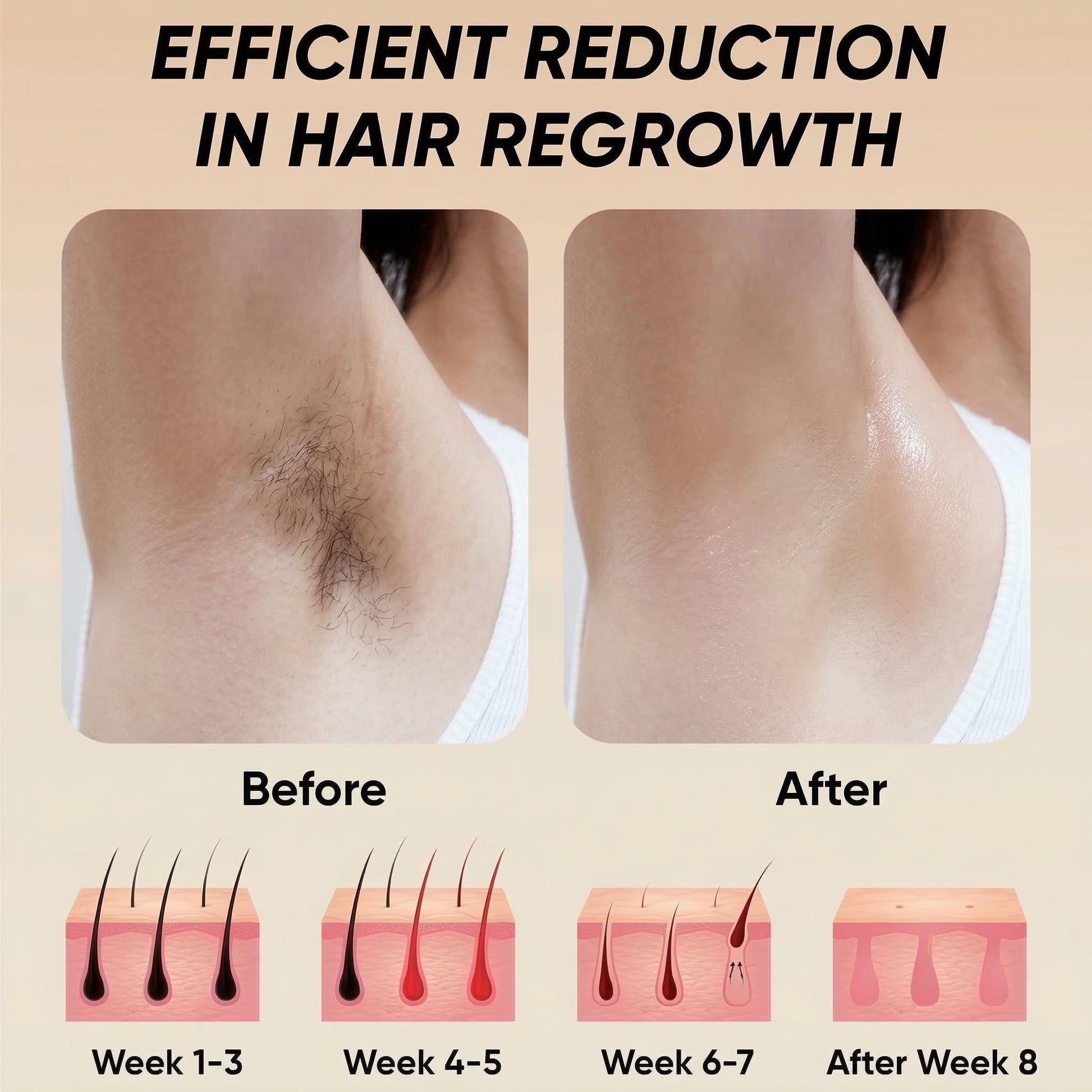 Advanced IPL Hair Removal Device Doba