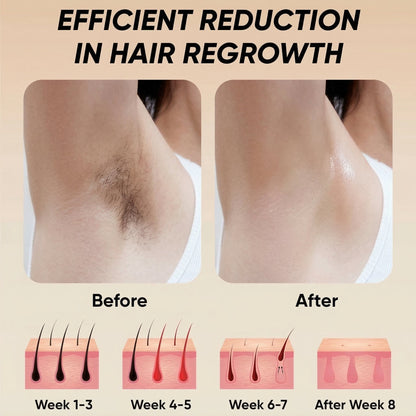 Advanced IPL Hair Removal Device Doba